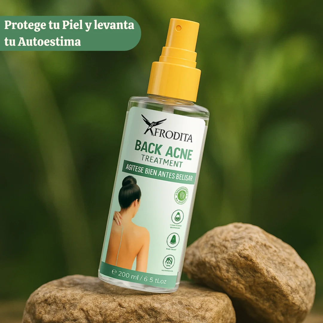 Back Acne | 200ML - Muestra tu Espalda Sin Pensar Dos Veces