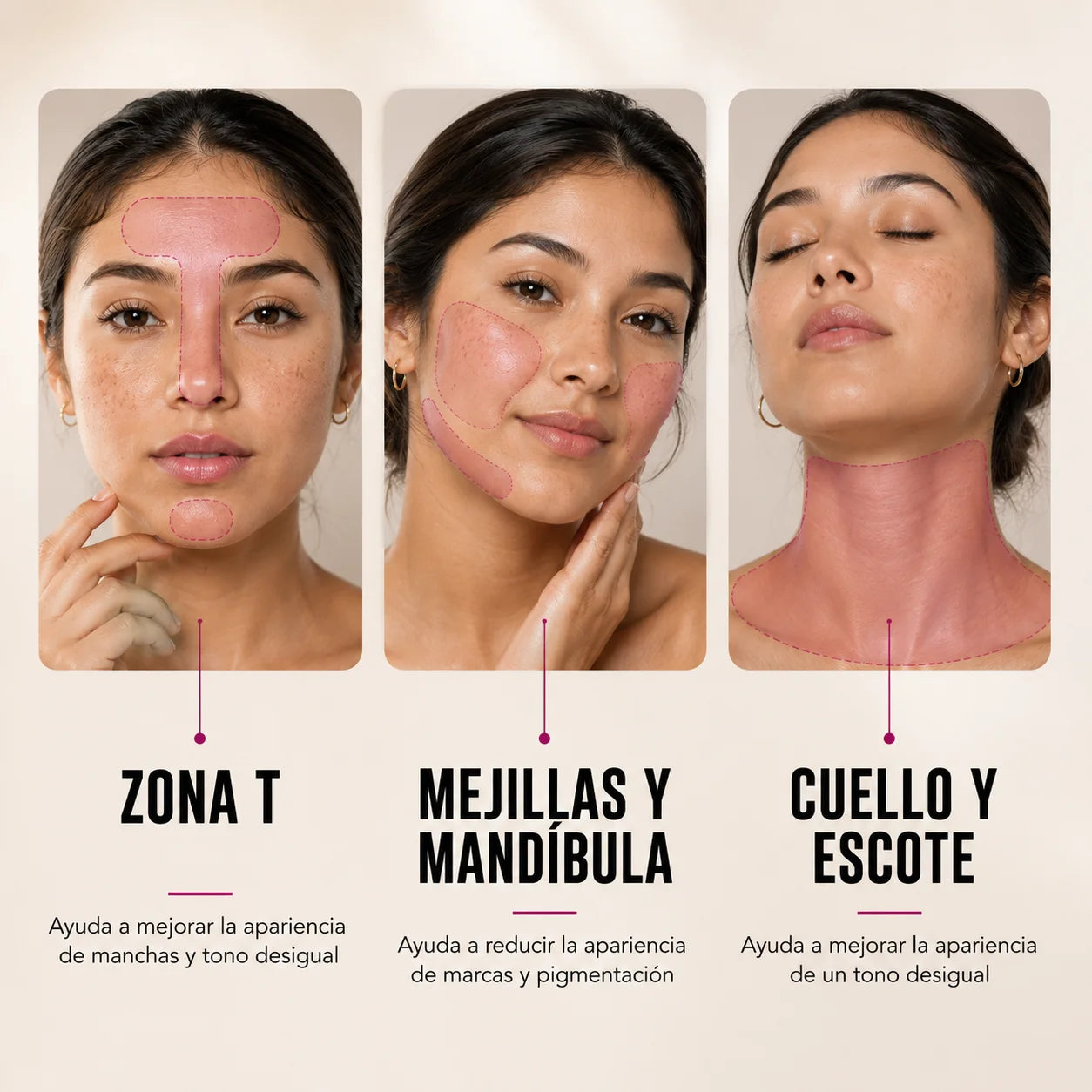 Crema Arbutin 7% + Ácido Tranexámico 4%