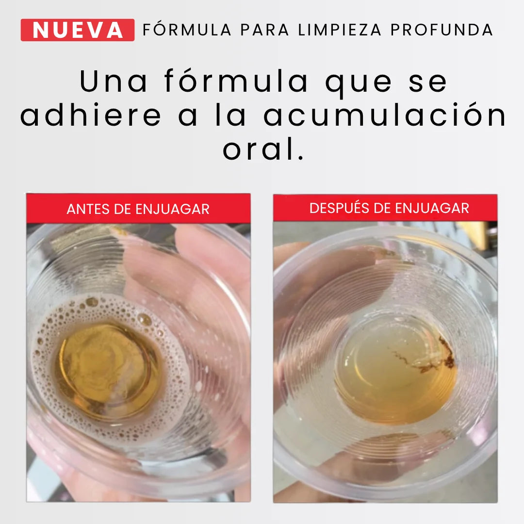 iD WHITENING - Tu cepillo solo limpia el 25% de tu boca.