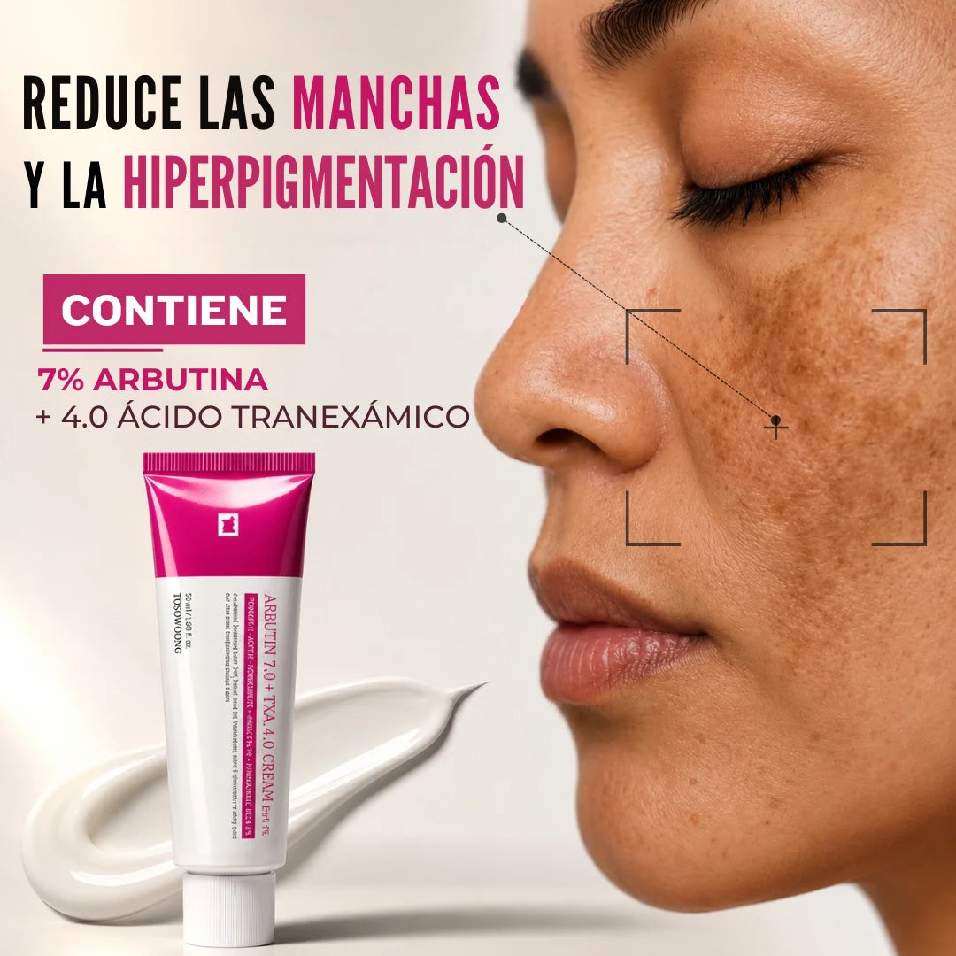 Crema Arbutin 7% - Elimina Manchas y la Hiperpigmentación